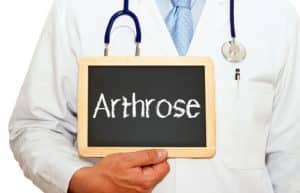 Arthrose : Kniearthrose, Hüftarthrose