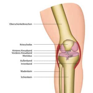 Knieoperationen, beispielsweise bei einem Meniskusschaden oder eine Bakerzyste, zählen mittlerweile zu den häufigsten chirurgischen Eingriffen.