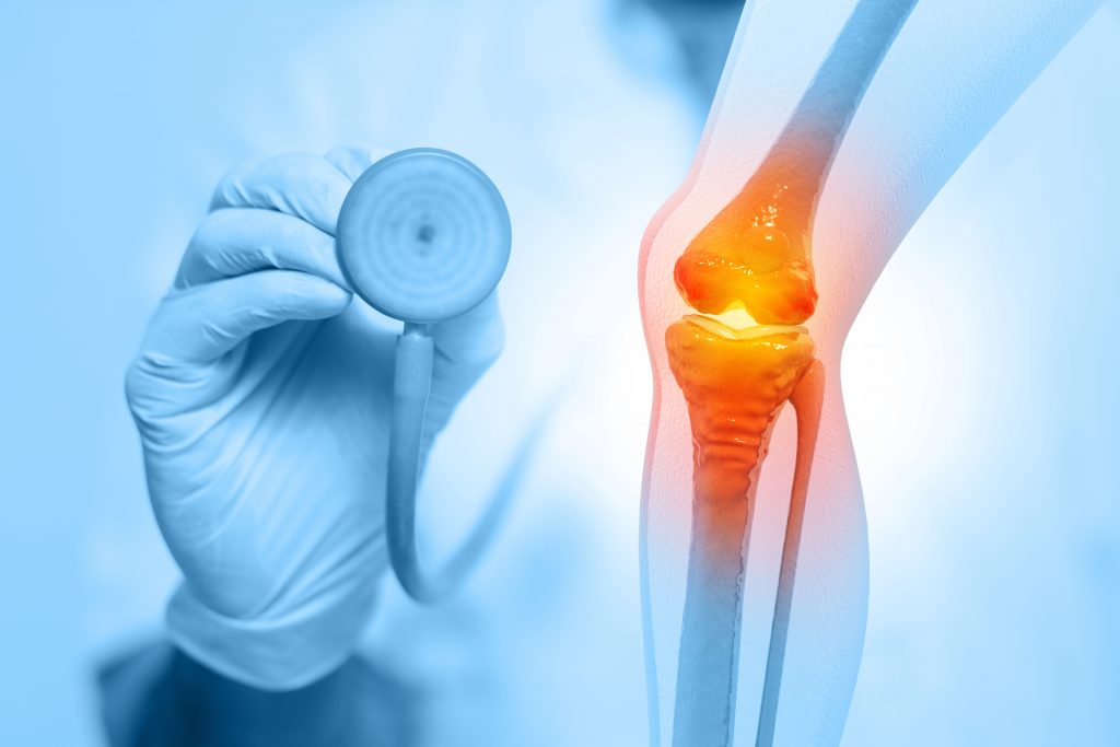 Orthopäden untersuchen die menschlichen Kniegelenke. Osteoarthritis, rheumatoide Arthritis, Gelenkerkrankungen. Behandlung von Kniegelenken und Knochen