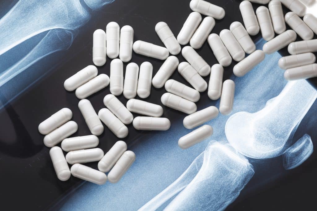 Röntgenbild und weiße Kapseln Chondroitin mit Nahrungsergänzungsmittel oder Medikament